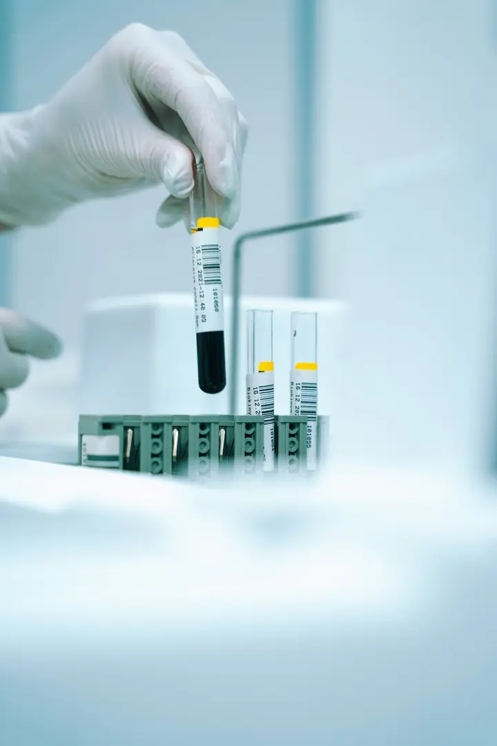 A gloved hand lifting a blood sample tube from a tray